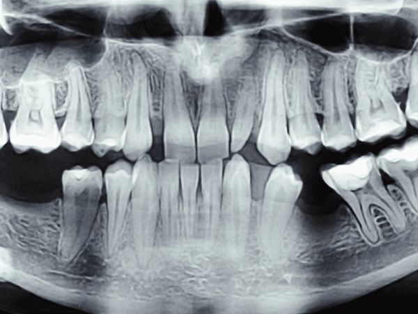 Before digital diagnosis treatment